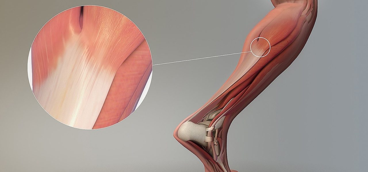 Tendon Yaralanmaları ve Tedavi Yöntemleri